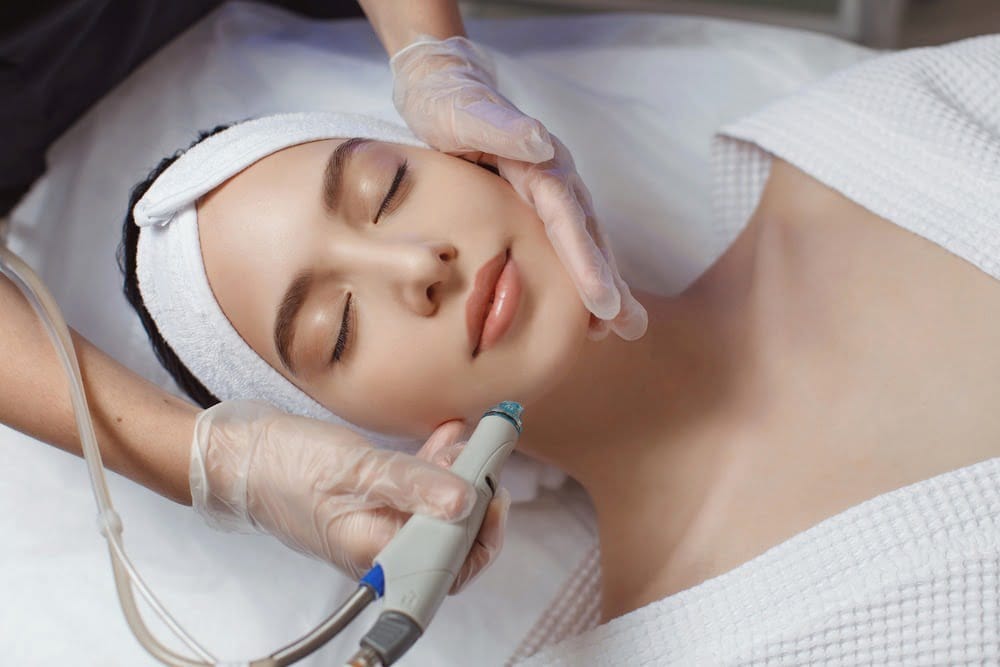 microdermabrasion benefits