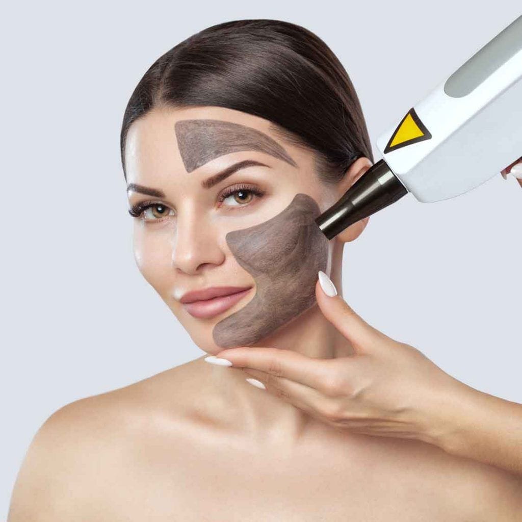 laser treatment for skin