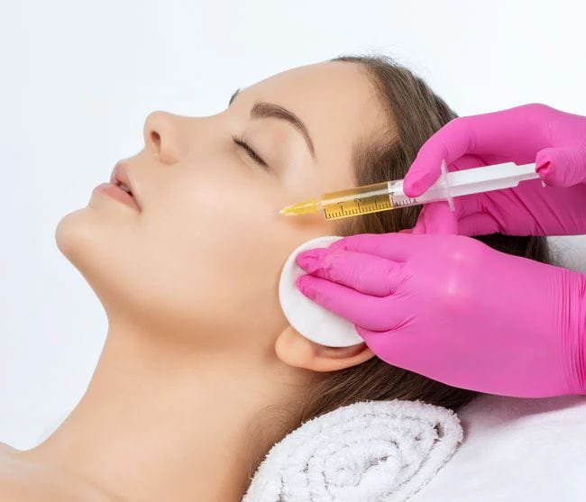 PRP facial treatment