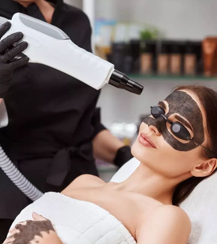 Carbon Laser Facial