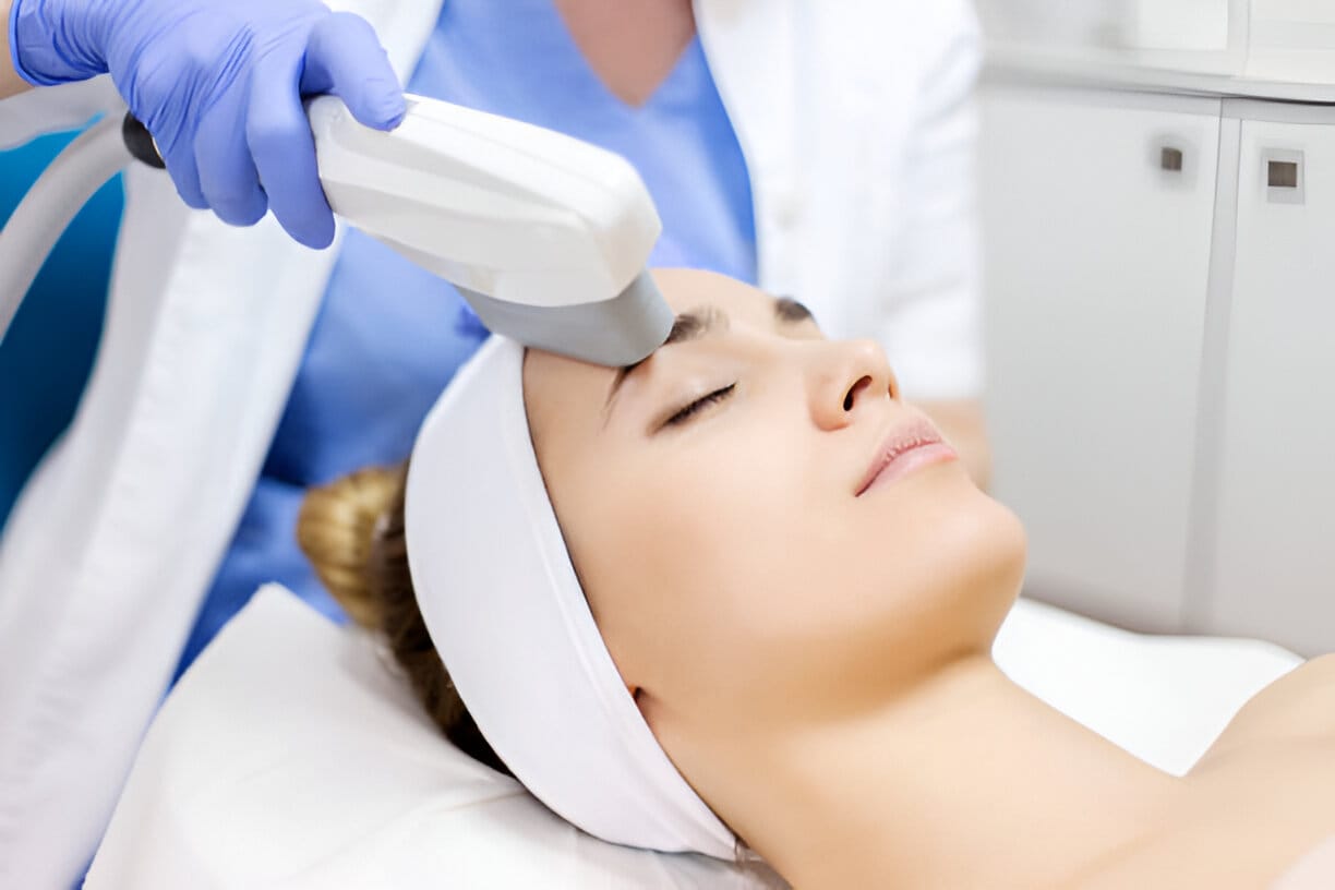 IPL treatment for skin