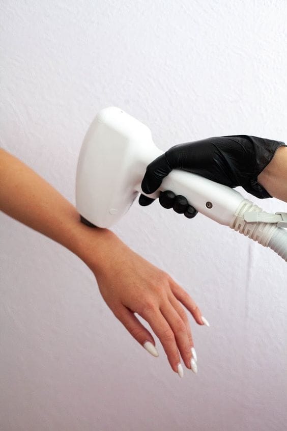 ICOONE laser treatment