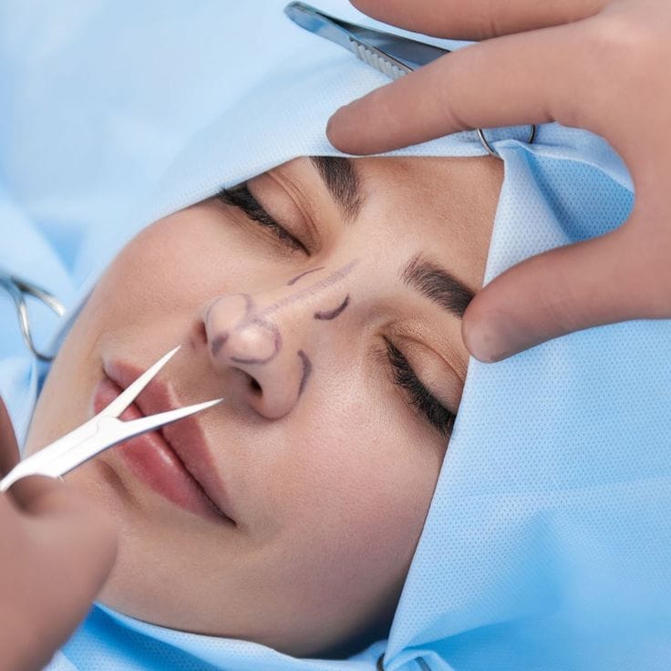 ultrasonic rhinoplasty