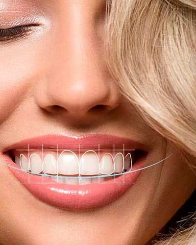 digital smile design