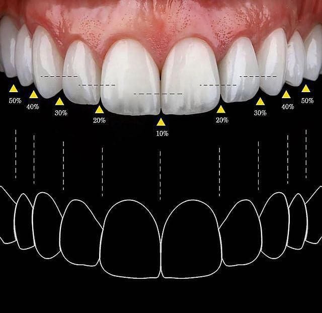 DSD dental