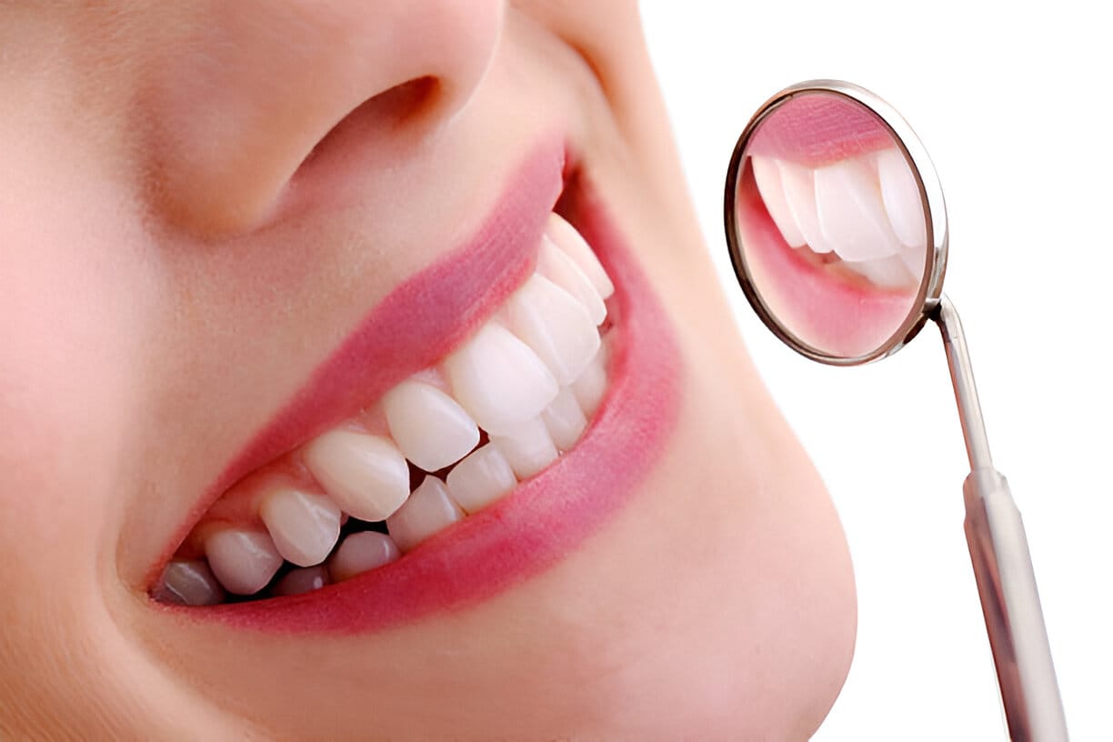 digital smile design