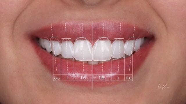 digital smile design